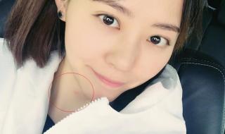 蚊子居然还有头发